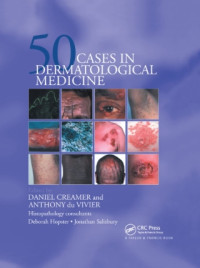 Image of 50 CASES IN DERMATOLOGICAL MEDICINE