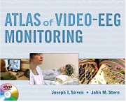 ATLAS OF VIDEO EEG MONITORING