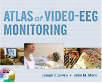 Image of ATLAS OF VIDEO EEG MONITORING
