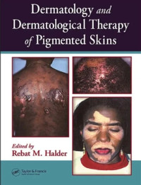 Image of DERMATOLOGY AND DERMATOLOGICAL THERAPY OF PIGMENTED SKINS