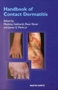 Image of HANDBOOK OF CONTACT DERMATITIS